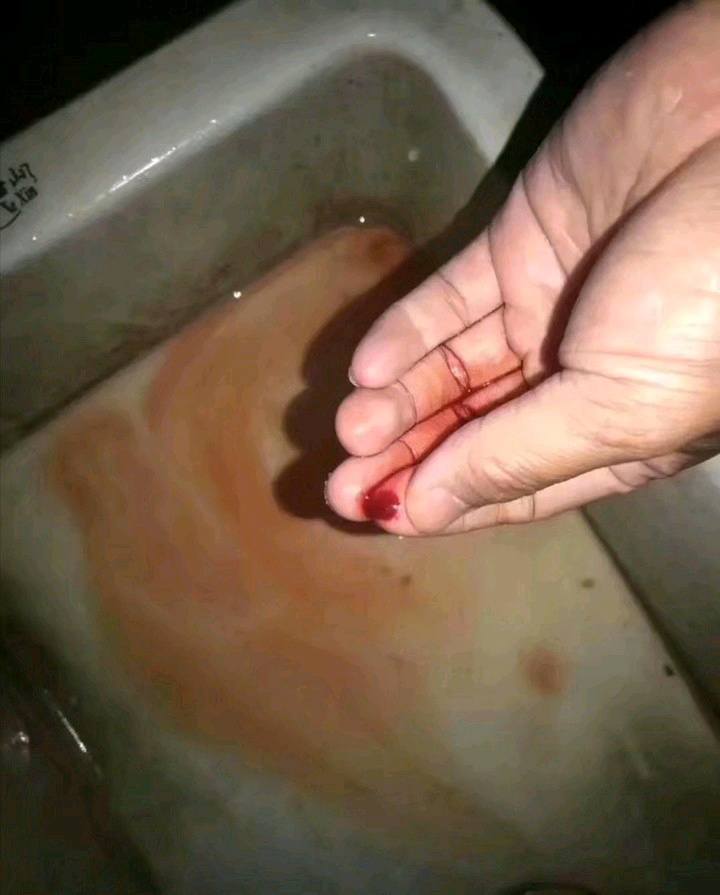 刚才抓了一只小龙虾,抓的时候被刺了一下,现在手还火辣辣的疼呢